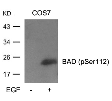 BAD(Phospho-Ser112)