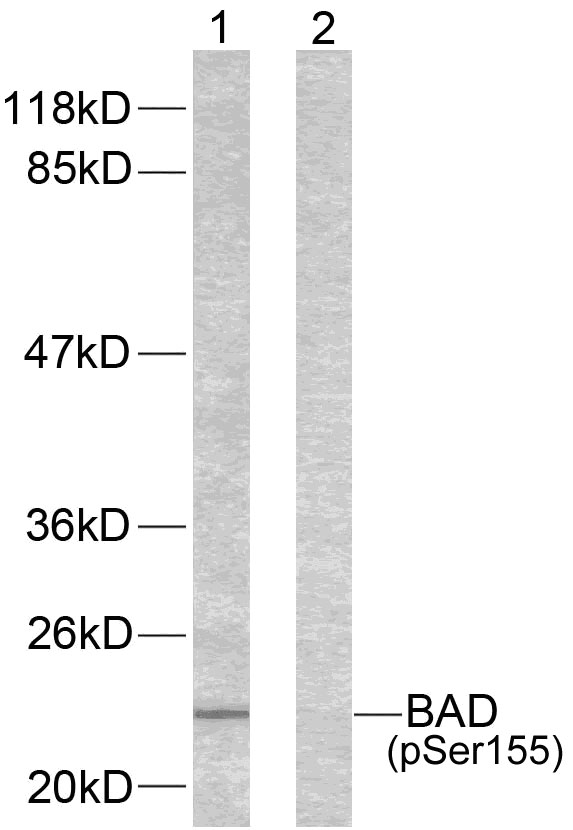 BAD(Phospho-Ser155)