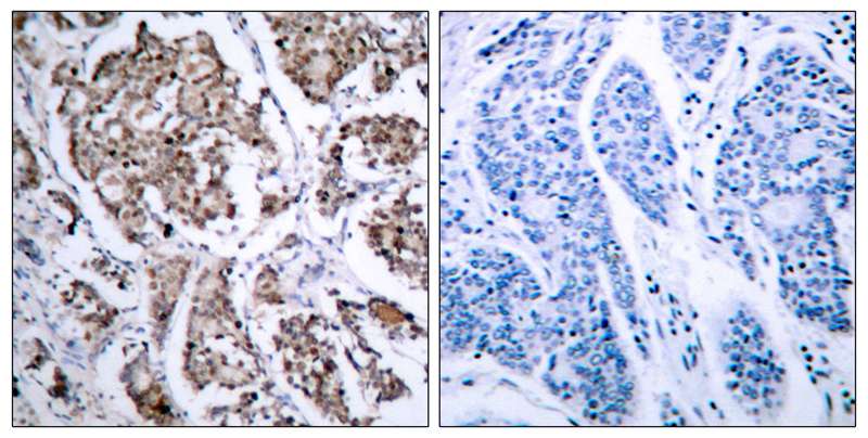 Rabbit Polyclonal Antibody to BAD(Phospho-Ser155)