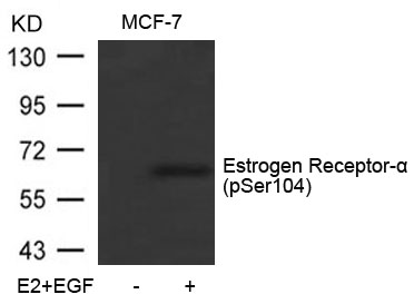Estrogen Receptor-a(Phospho-Ser104)