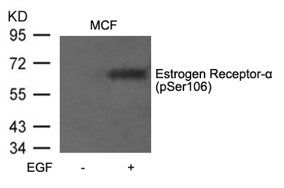 Estrogen Receptor-a(Phospho-Ser106)