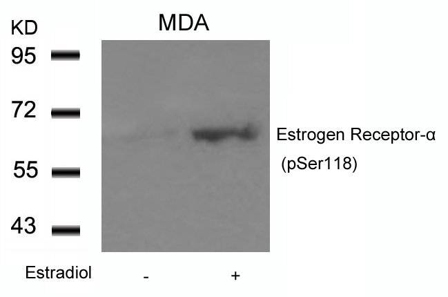 Estrogen Receptor-a(Phospho-Ser118)