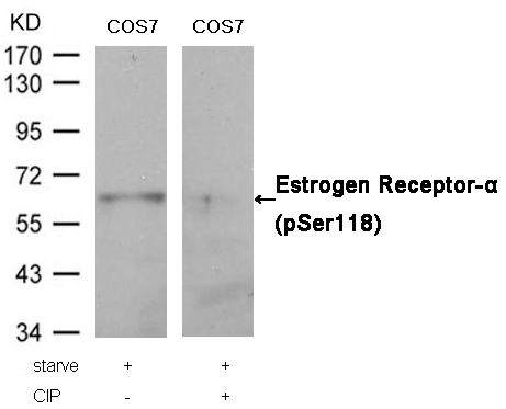 Rabbit Polyclonal Antibody to Estrogen Receptor-a(Phospho-Ser118)