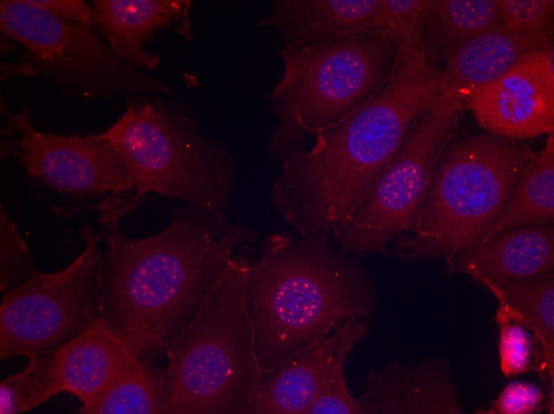 Rabbit Polyclonal Antibody to Estrogen Receptor-a(Phospho-Ser167)