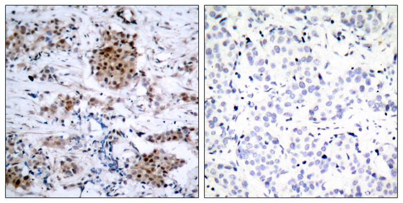 Rabbit Polyclonal Antibody to Estrogen Receptor-a(Phospho-Ser167)