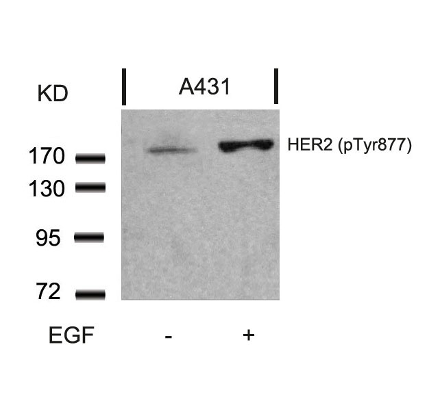 HER2(Phospho-Tyr877)
