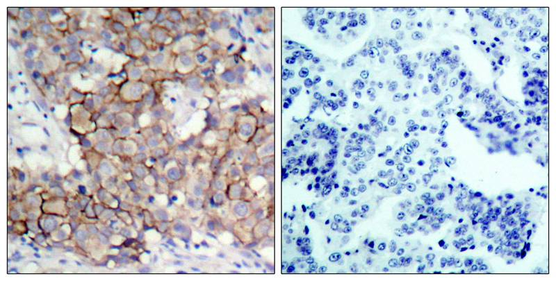 Rabbit Polyclonal Antibody to HER2(Phospho-Tyr877)