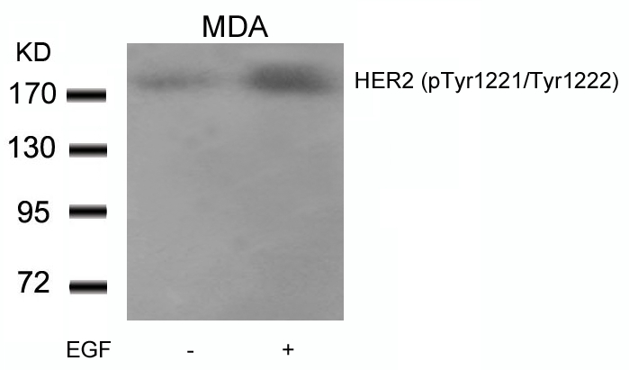 HER2(Phospho-Tyr1221/Tyr1222)