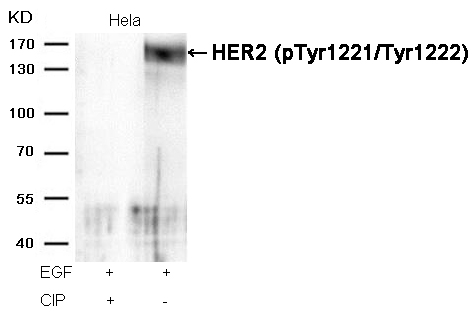 Rabbit Polyclonal Antibody to HER2(Phospho-Tyr1221/Tyr1222)