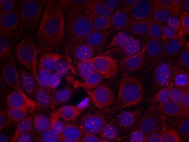 Rabbit Polyclonal Antibody to HER2(Phospho-Tyr1221/Tyr1222)