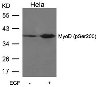 MyoD(Phospho-Ser200)