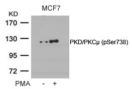 PKD/PKCm(Phospho-Ser738)