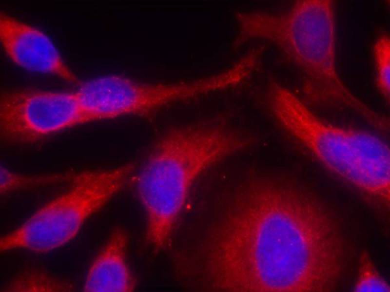 Rabbit Polyclonal Antibody to PKD/PKCm(Phospho-Ser738)