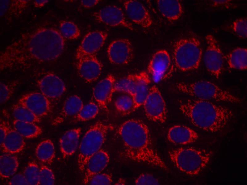 HER2(Phospho-Tyr1248)