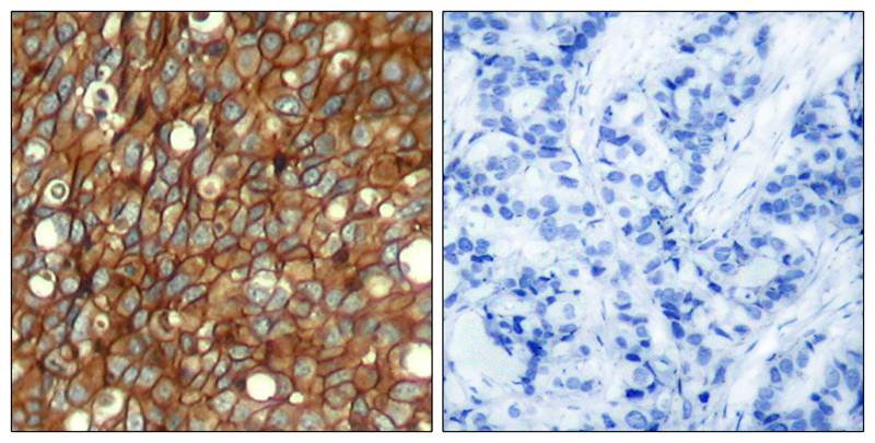 Rabbit Polyclonal Antibody to HER2(Phospho-Tyr1248)