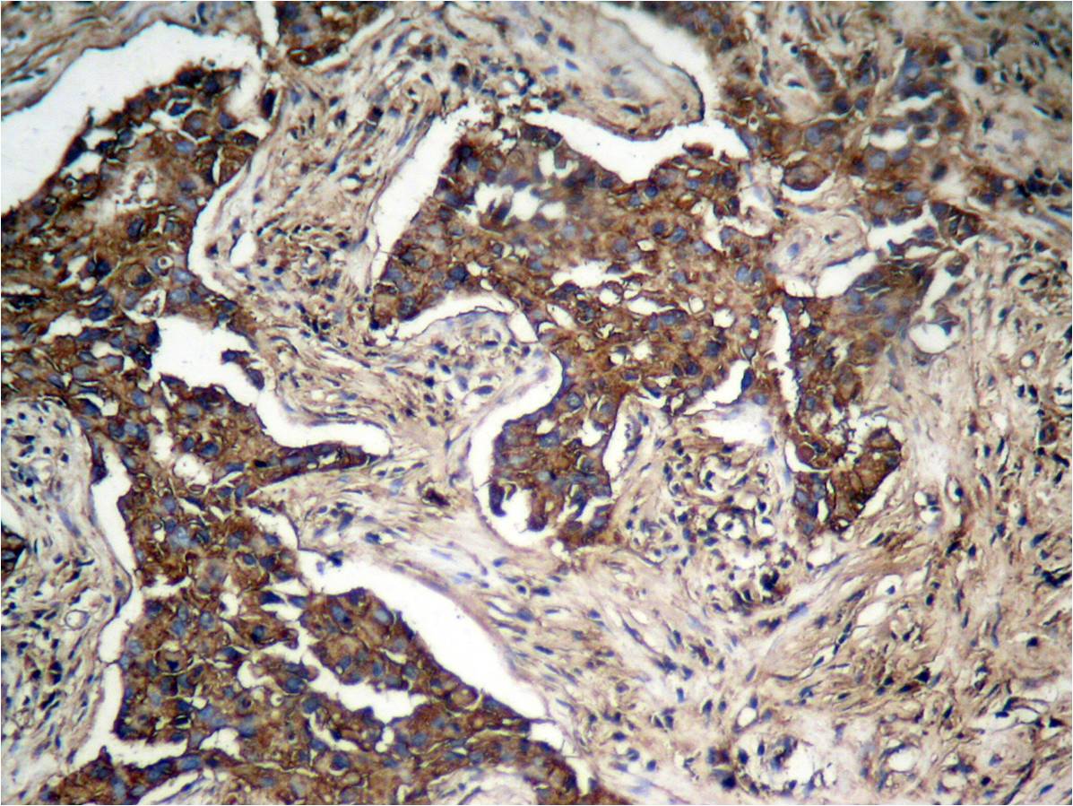 Rabbit Polyclonal Antibody to HER2(Phospho-Tyr1248)