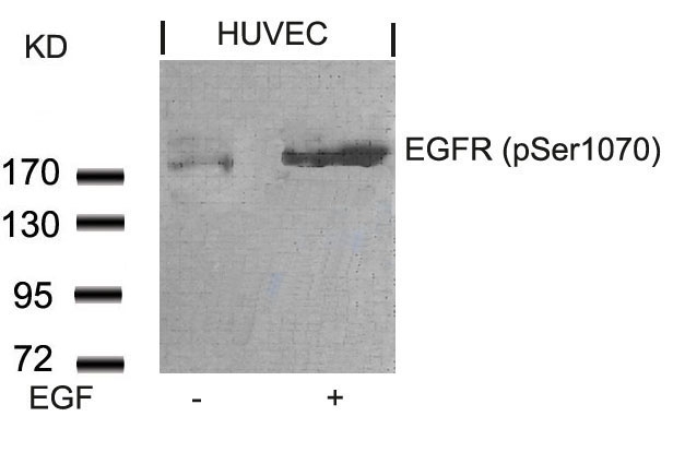 EGFR(Phospho-Ser1070)