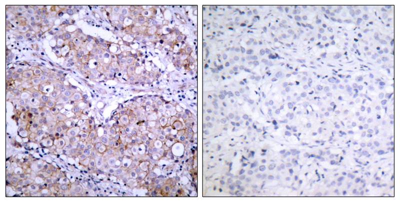 Rabbit Polyclonal Antibody to EGFR(Phospho-Ser1070)