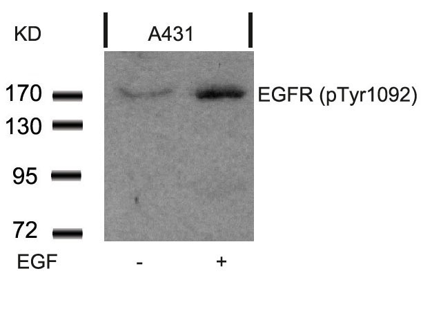 EGFR(Phospho-Tyr1092)