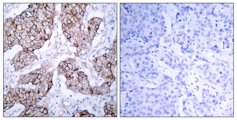 Rabbit Polyclonal Antibody to EGFR(Phospho-Tyr1092)