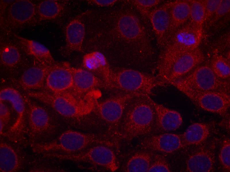 VEGFR2(Phospho-Tyr1175)