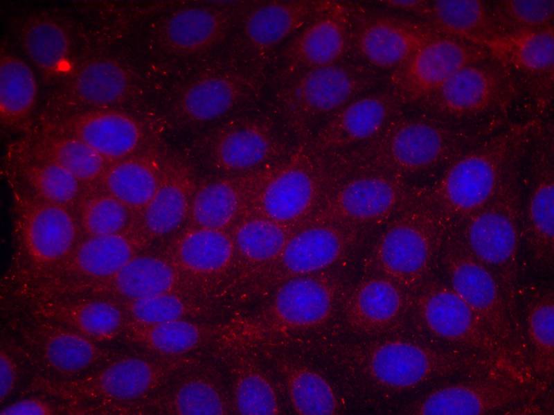 Rabbit Polyclonal Antibody to VEGFR2(Phospho-Tyr1214)