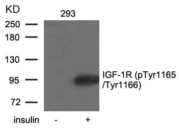 IGF-1R(Phospho-Tyr1165/Tyr1166)