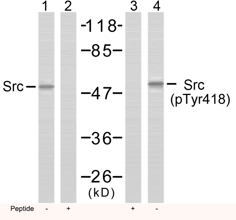 Src(Phospho-Tyr418)