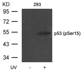 p53(Phospho-Ser15)