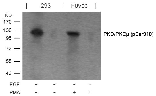 PKD/PKCm(Phospho-Ser910)