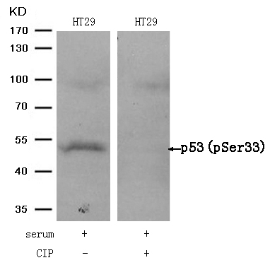 Rabbit Polyclonal Antibody to p53(Phospho-Ser33)