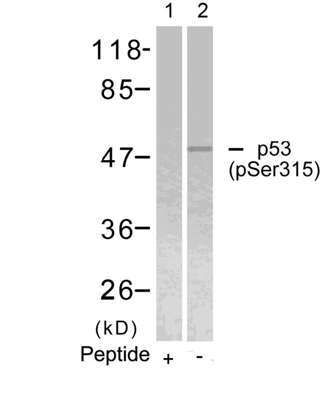 p53(Phospho-Ser315)
