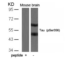 Tau(Phospho-Ser356)