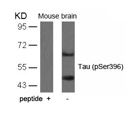 Tau(Phospho-Ser396)