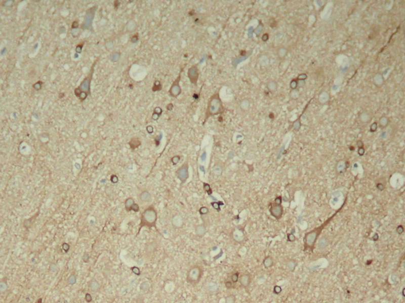 Rabbit Polyclonal Antibody to Tau(Phospho-Ser396)