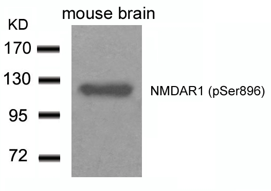 NMDAR1(Phospho-Ser896)