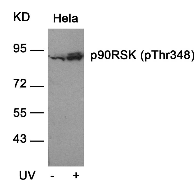 p90RSK(Phospho-Thr348)
