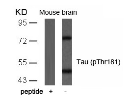 Tau(Phospho-Thr181)