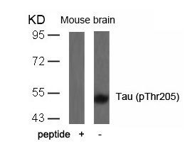 Tau(Phospho-Thr205)