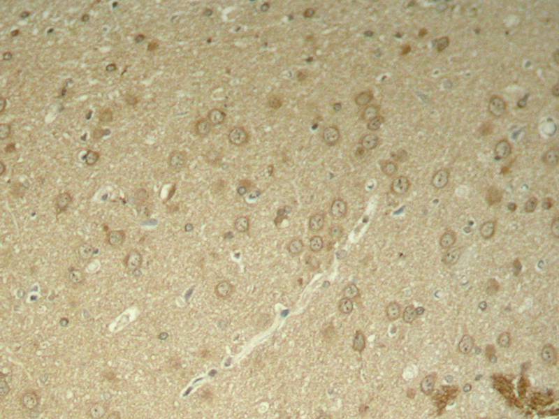 Rabbit Polyclonal Antibody to Tau(Phospho-Thr205)