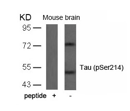 Tau(Phospho-Ser214)