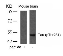 Tau(Phospho-Thr231)