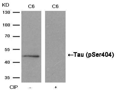 Tau(Phospho-Ser404)