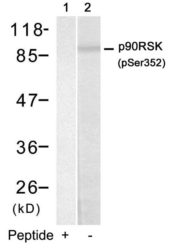 p90RSK(Phospho-Ser352)
