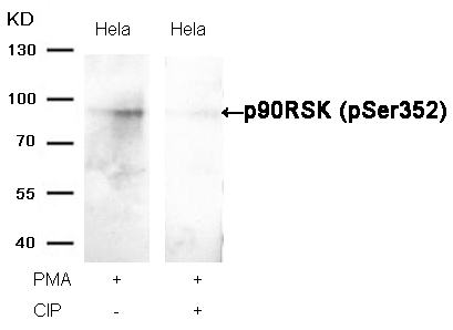 Rabbit Polyclonal Antibody to p90RSK(Phospho-Ser352)