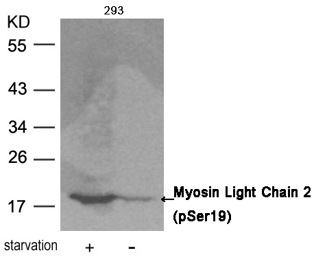 Myosin Light Chain 2 (Phospho-Ser19)