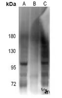 Androgen Receptor(Phospho-Ser213)