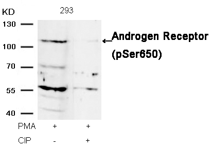 Androgen Receptor(Phospho-Ser650)