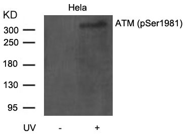 ATM(Phospho-Ser1981)