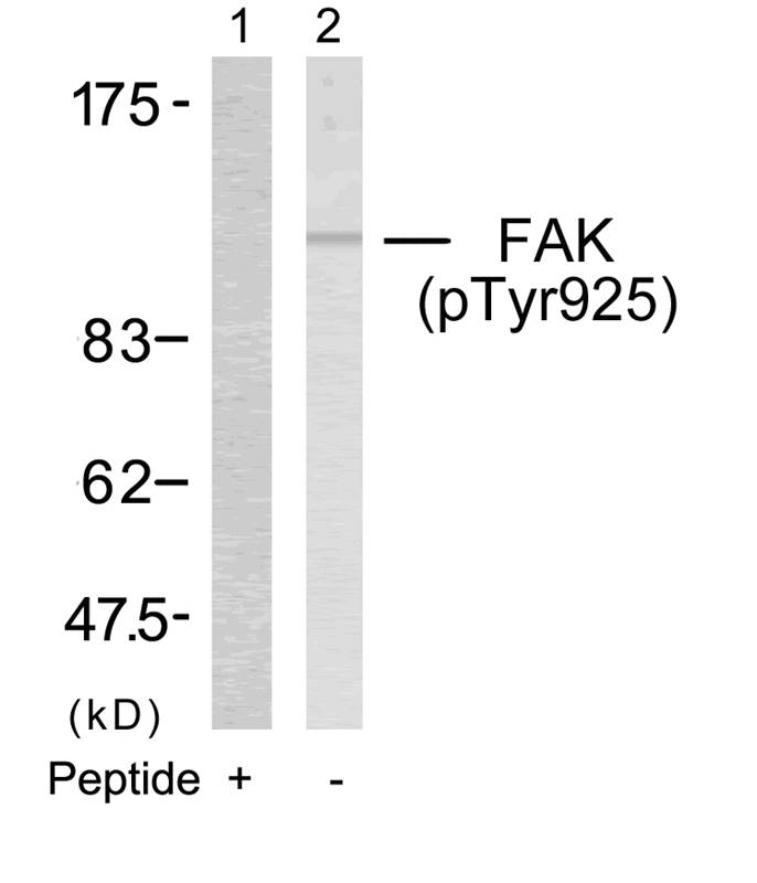 FAK(Phospho-Tyr925)